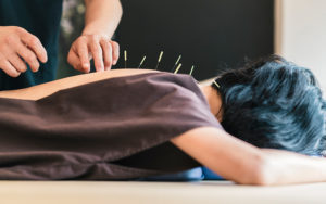 Unlock the Healing Power of Acupuncture